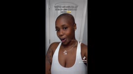 'Chemicals too strong!' Woman loses all her hair after using Mizani hair relaxer