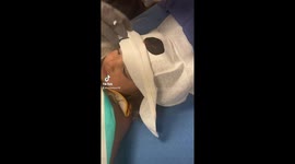 Dad passes out seeing daughter get stitches