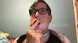 THIS WOMAN was bullied severely for a condition that left her with cysts in her face and considered suicide but was saved from death by her ‘guardian angel’ the dream man she first met online and is now happily married to.