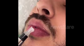 Using the viral lip filler pen on my boyfriend