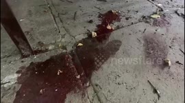 In Kherson, there are already 23 wounded, including three children, after a massive daytime shelling