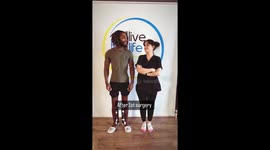 Man spends £64,000 on limb-lengthening surgery after being 'rejected' by women for being 'too short' – he's now half a FOOT taller PART 1/4