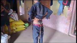 Hairy Tail People calling this boy an incarnation of Lord Hanuman, reason is his 2 feet long tail