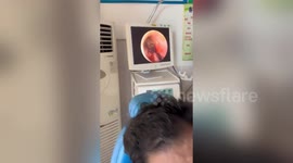 Spider crawls into man's ear and spins a web while he sleeps