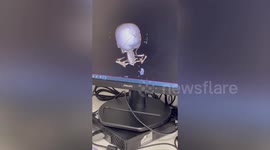 Boy's skull put back together 'like a jigsaw' after life-saving op to stop his brain being crushed