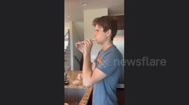 THIS MAN has endured being called “Half face” but his identical twin is a thankful reminder of how he would have looked without the devastating condition that is causing his face to cave into itself.