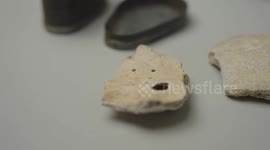 Businessman Gives Pieces Of Beethoven's Skull To The Medical University of Vienna, Austria