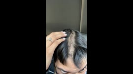 Woman left with half a skull after sinus infection led to brain tumour