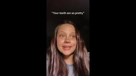 ‘I had 21 teeth removed to fix my smile – I’m 29 with dentures and show off my gums for fun'