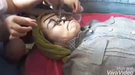 Experts warn against bizarre 'earthworm spa' that can cause infections