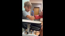 Boy surprised to see a rubber stuck to his wrist after cast removal