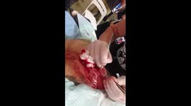 Man gets heart shape scarified onto his chest