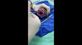 Vet carefully removes ROCKS from greedy frog's stomach