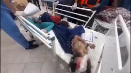 Injured children tended to at hospital following strike that hit Gaza's Jabalia refugee camp