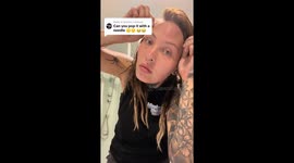 Woman says doctors left stumped as 'mysterious lump size of golfball' appears on her forehead – then disappears overnight (Part 3)