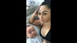 Mum called ‘monster’ for lasering baby’s face defends controversial treatment (Part 5)