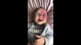 Mum called ‘monster’ for lasering baby’s face defends controversial treatment (Part 2)