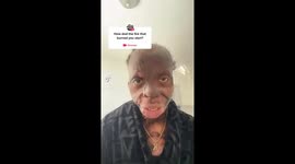 ‘I have burn scars on 90% of my body – my love life is non-existent' (Pt 3)