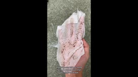 Hairdresser terrifies internet with little-known HEAD LICE facts – including how they can hide on scalp for SIX WEEKS