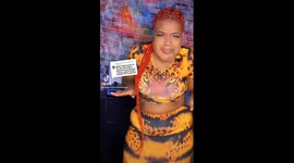 'People call me ugly and say I look like a cartoon character – but I've learned to love my facial difference' (Part 3)