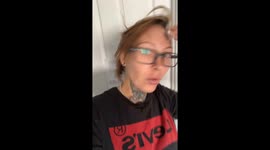 Woman says doctors left stumped as 'mysterious lump size of golfball' appears on her forehead – then disappears overnight (Part 1)