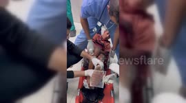 Victims of Israeli Airstrike Receive Treatment at Khan Yunis Hospital