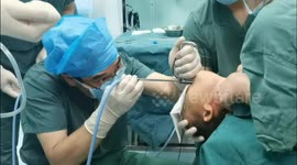 Medics remove crushed peanuts stuck in two-year-old boy's airway