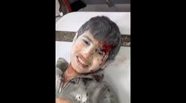 A family survived an Israeli bombing after an IDF missile fell on their house without exploding in Gaza