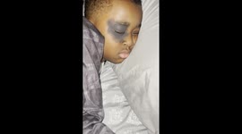 Elf on the shelf prank when kid gets a fake black eye as a prank