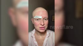 Woman with alopecia gets ready for work the night before and sleeps with her hair and eyebrows done