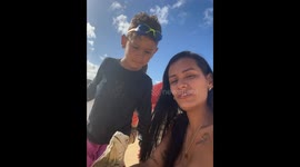 Iguana's startling bite leaves young boy stunned