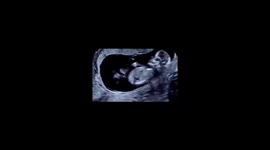 Fascinating ultrasound video captures baby's gentle twitching, possibly hiccups in womb