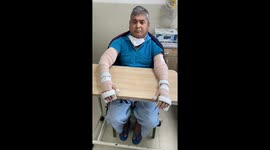Header - Double amputee who lost limbs in accident gets woman hands attached in unbelievable operation
