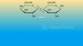 Lactose Intolerance - Types, Causes, Pathophysiology, Signs & Symptoms, And Treatment