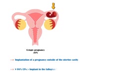 Ectopic Pregnancy - Causes, Risk  Factors, Signs & Symptoms, And Treatment