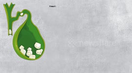 What Causes Gallstones? Major Causes Of Gallstone Disease |Gallstones Causes