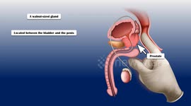 Best Foods For A Healthy Prostate |Top 6 Prostate-Friendly Foods |Prostate Superfoods