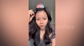 Girl, 22, has crack in the middle of her forehead due to rare condition morphoea