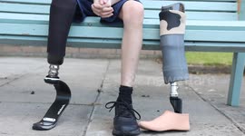 Little boy who lost his foot at 18 months now models for Primark, Amazon and Schuh
