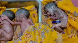 A woman gave birth to 5 daughters together, all the children along with the mother were healthy on Northern India