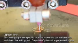 USA: WSU's AI Streamlines 3D Printing of Kidneys and Prostates