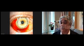 Red eye - What causes it ? Should I be worried? What is the treatment? When should I seek help?