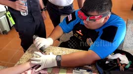 Chinese tourist rescued with ring stuck on swollen finger