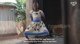 Bow-legged schoolgirl had life-changing straightening surgery - and got 14cm taller