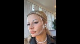 Person's eyebrow ripped off while removing collagen face mask in Exeter, UK