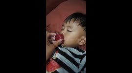 Huge lips of a child after putting bottle cap. Prank!