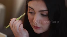 Medical student has rare hand transplant - to help her become a doctor