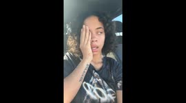 Woman's eyes fail to sync after dentist visit in Spring Hill, Florida, USA