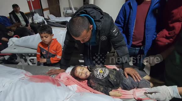 Israeli attacks on Gaza leave casualties, including children