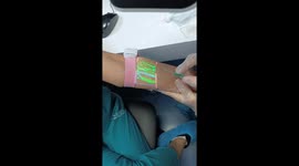 Professional nurse demonstrates vein finder in viral venipuncture video